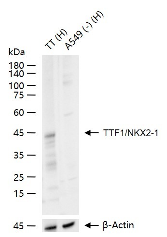 Anti-NKX2-1 Polyclonal Antibody