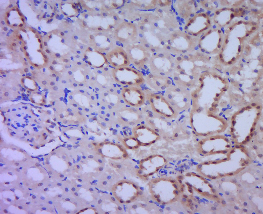 Anti-Nitro-Alpha-synuclein (Tyr39) Polyclonal Antibody