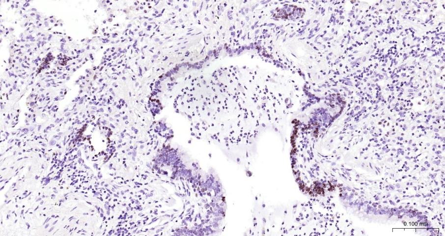 Anti-NKX2-1 Polyclonal Antibody