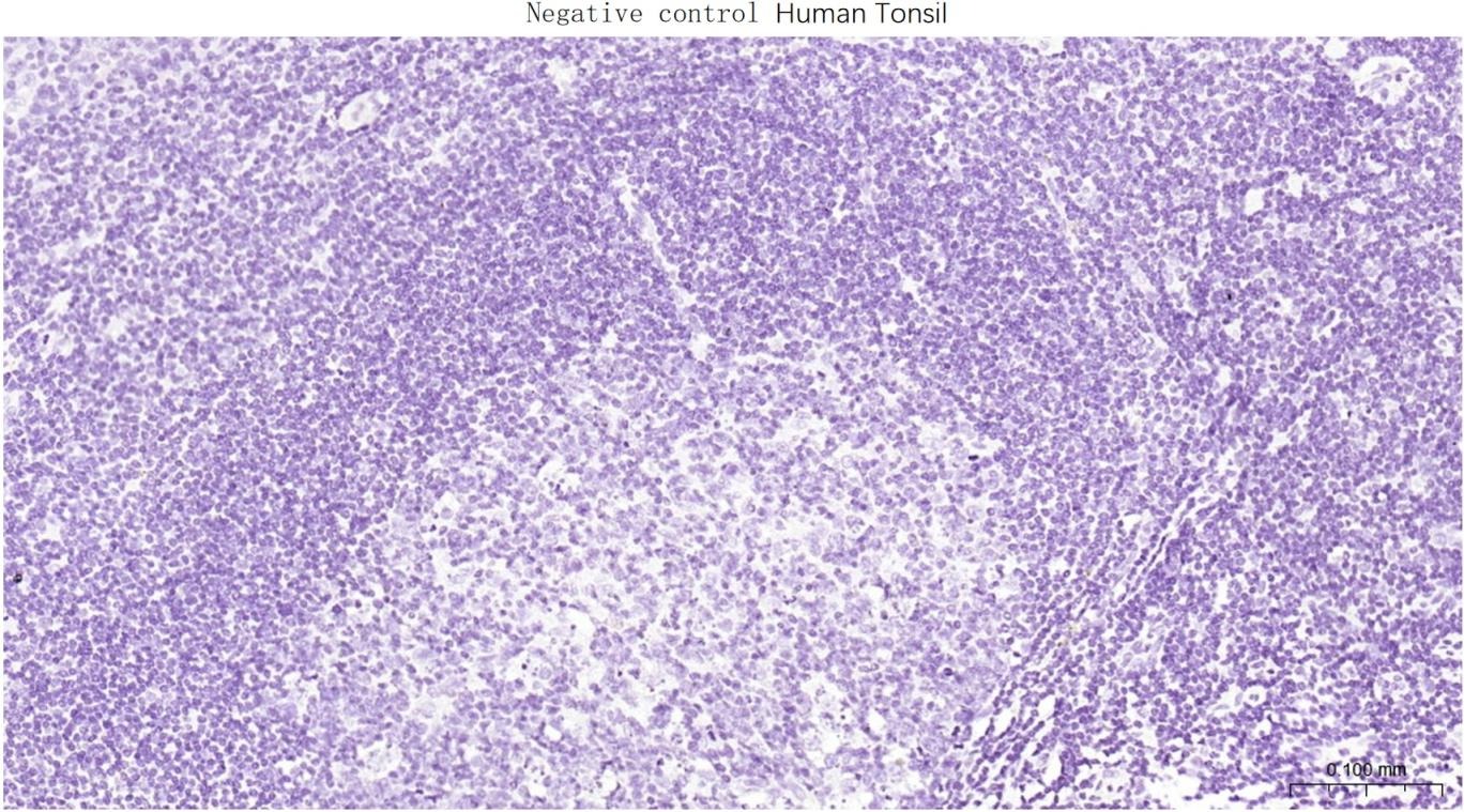 Anti-NKX2-1 Polyclonal Antibody