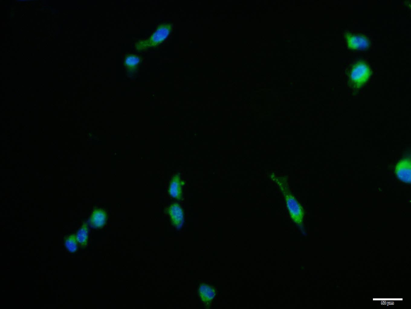 Anti-NGF Polyclonal Antibody 2