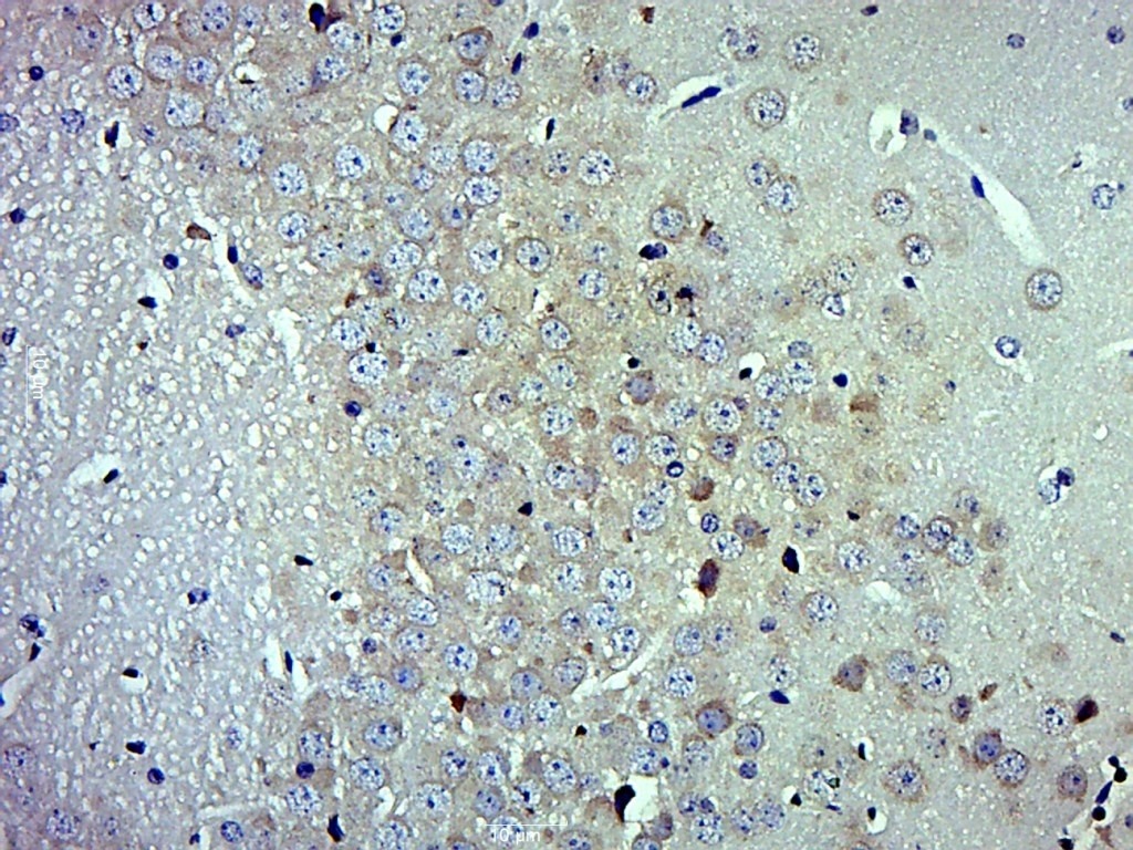 Anti-NCAM1 Polyclonal Antibody 2