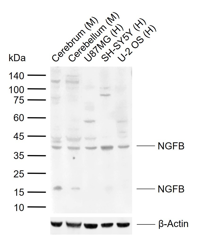 Anti-NGF Polyclonal Antibody 2