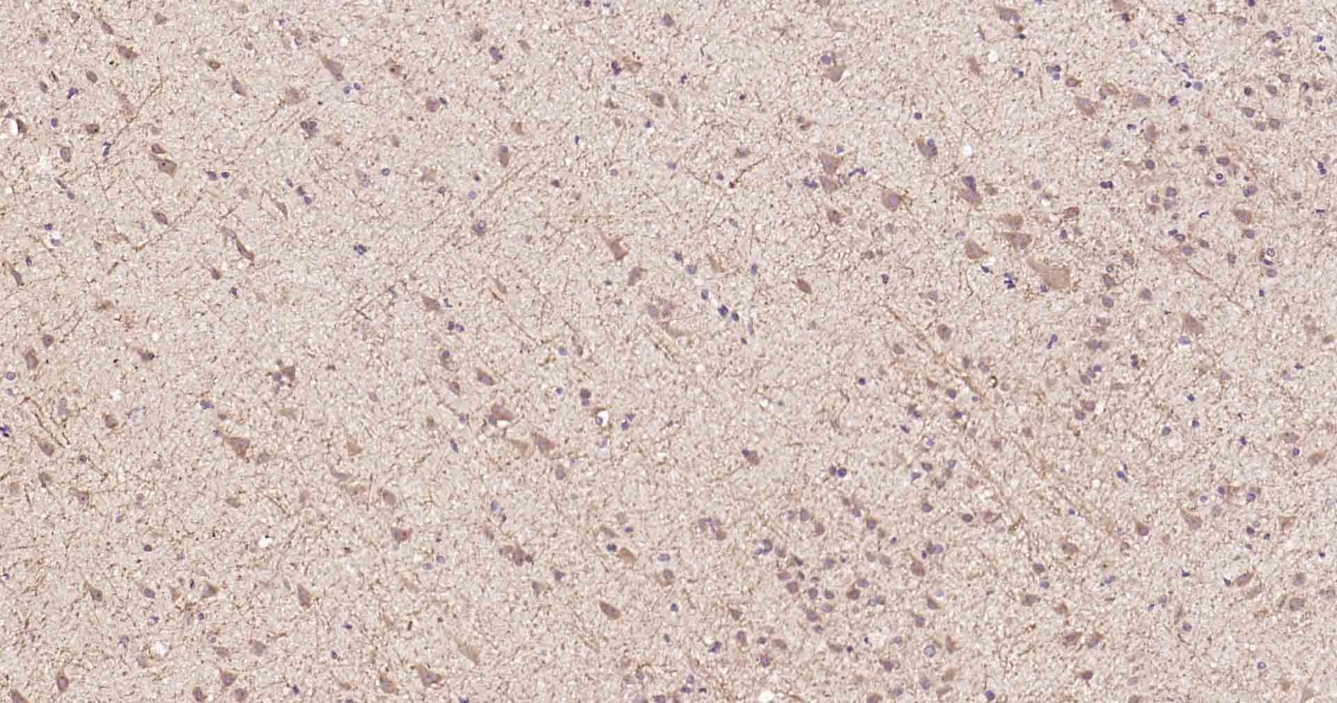 Anti-MTNR1B Polyclonal Antibody