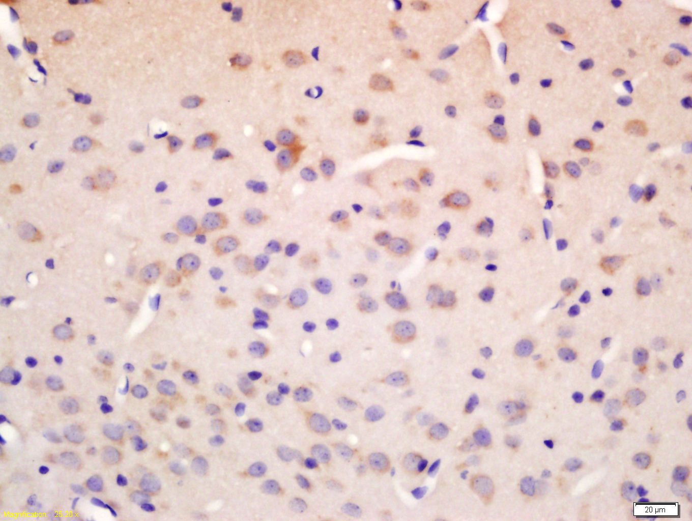 Anti-NCX1 Polyclonal Antibody