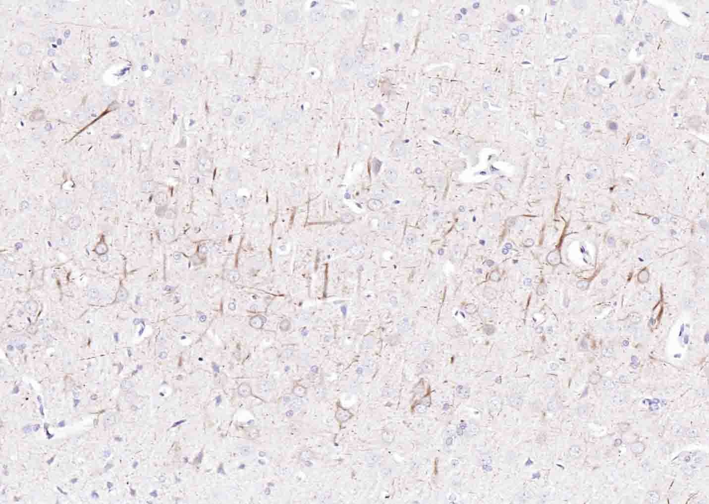 Anti-NEFH Polyclonal Antibody