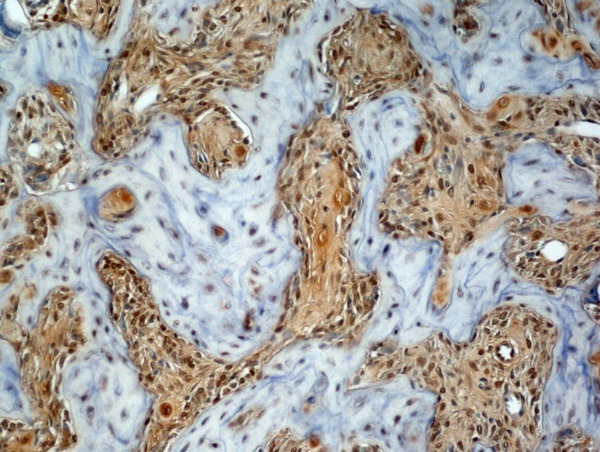 Anti-Osteocalcin Polyclonal Antibody