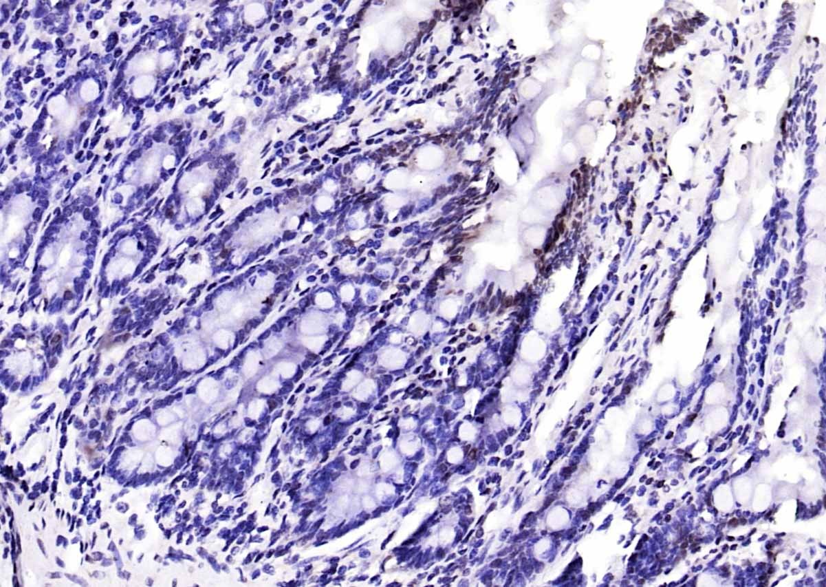 Anti-NCOA4 Polyclonal Antibody