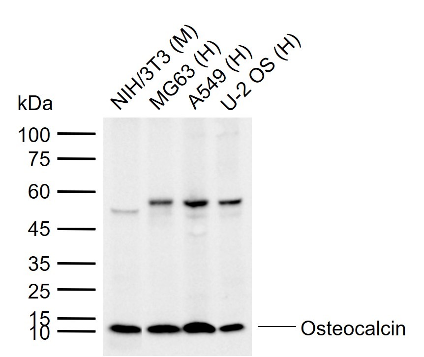 Anti-Osteocalcin Polyclonal Antibody 2