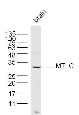 Anti-MTLC Polyclonal Antibody