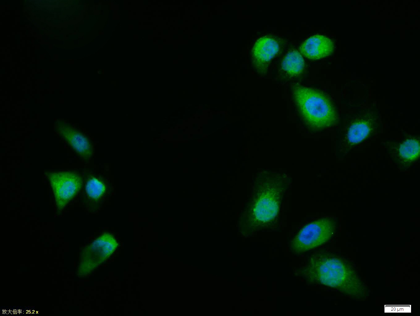 Anti-mTOR Polyclonal Antibody