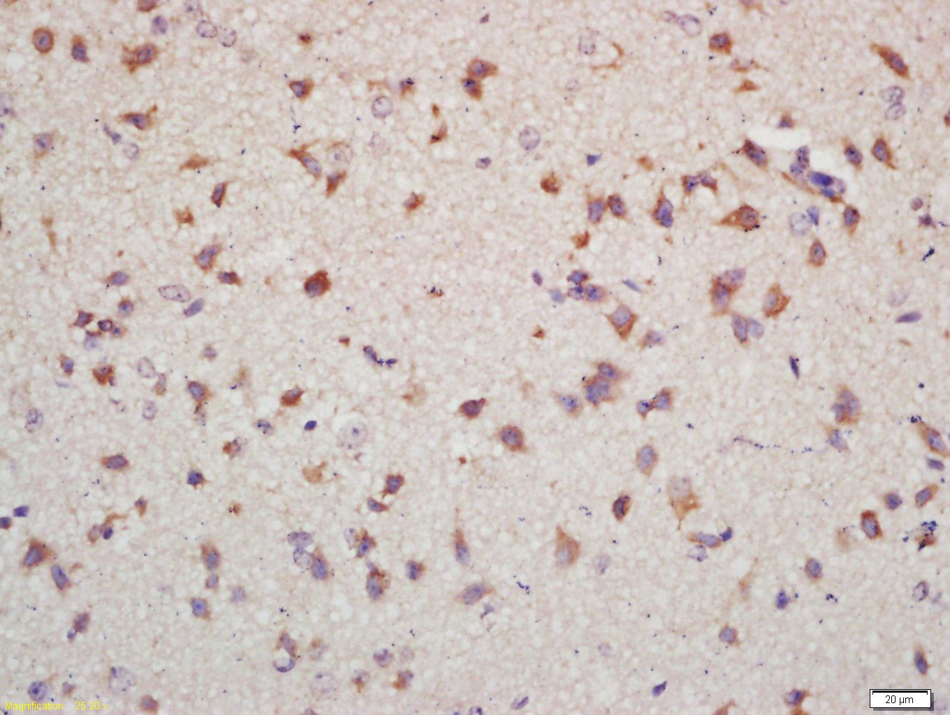 Anti-NET1 Polyclonal Antibody