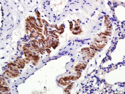 Anti-Osteopontin Polyclonal Antibody 2
