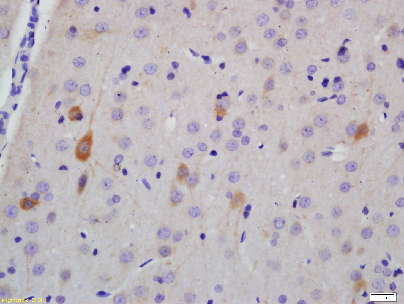 Anti-NEFH Polyclonal Antibody 2
