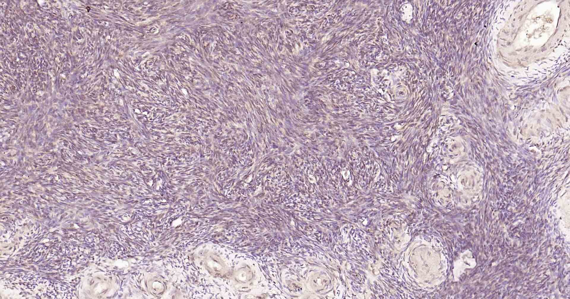 Anti-MTNR1B Polyclonal Antibody
