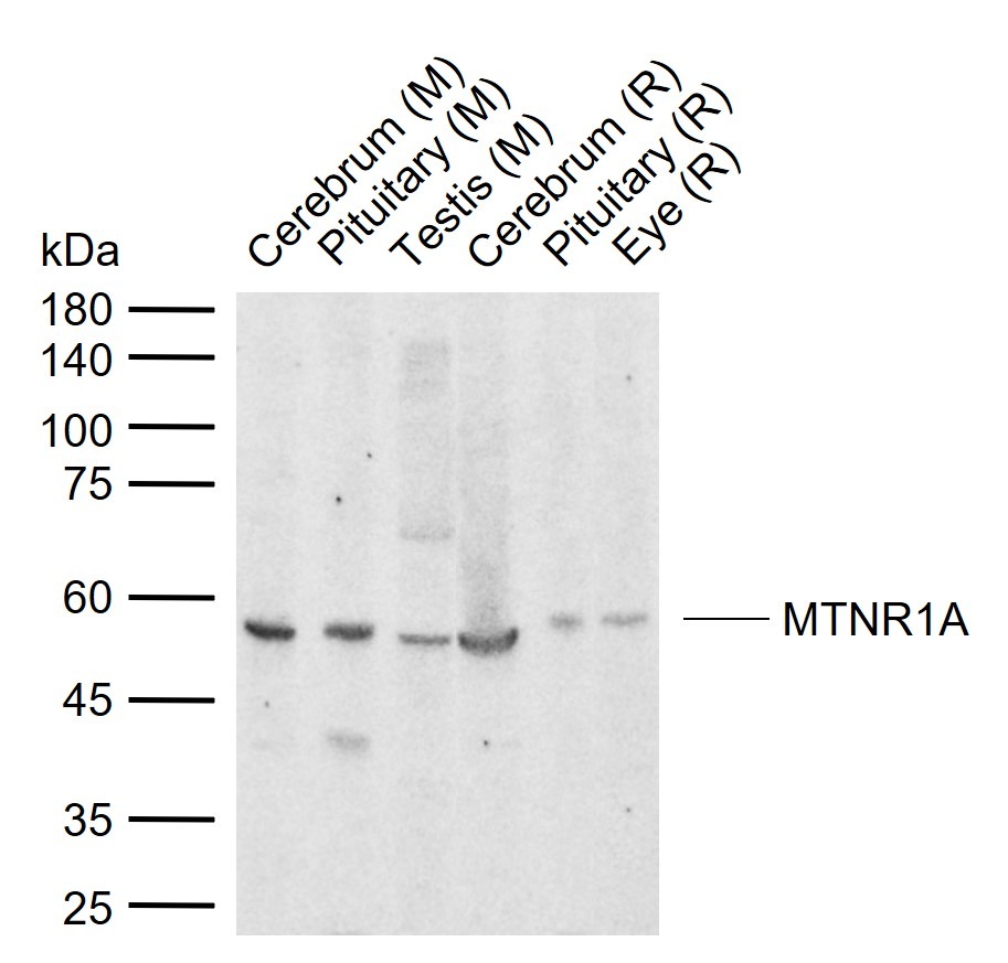 Anti-MTNR1A Polyclonal Antibody