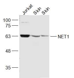Anti-NET1 Polyclonal Antibody