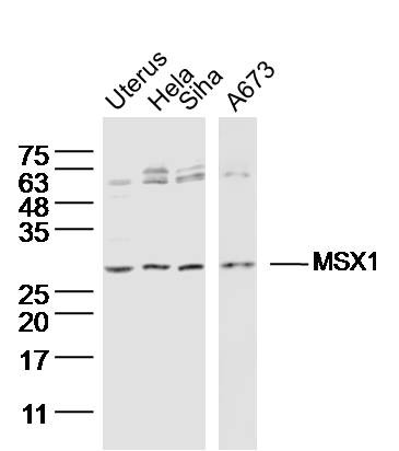 Anti-MSX1 Polyclonal Antibody