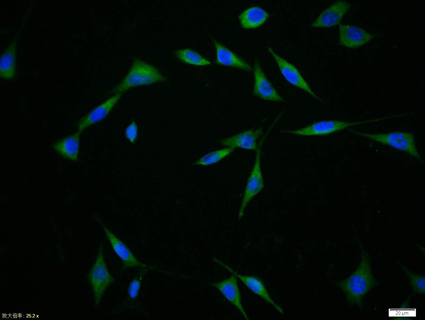 Anti-NEFH Polyclonal Antibody 2