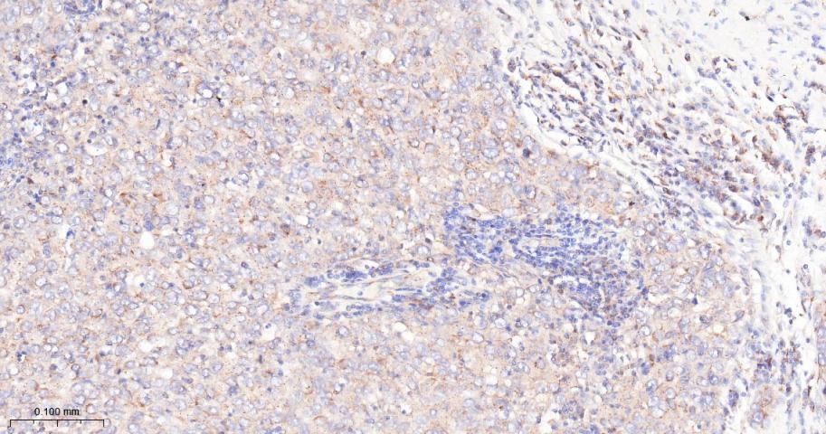 Anti-mTOR Antibody (2K378)