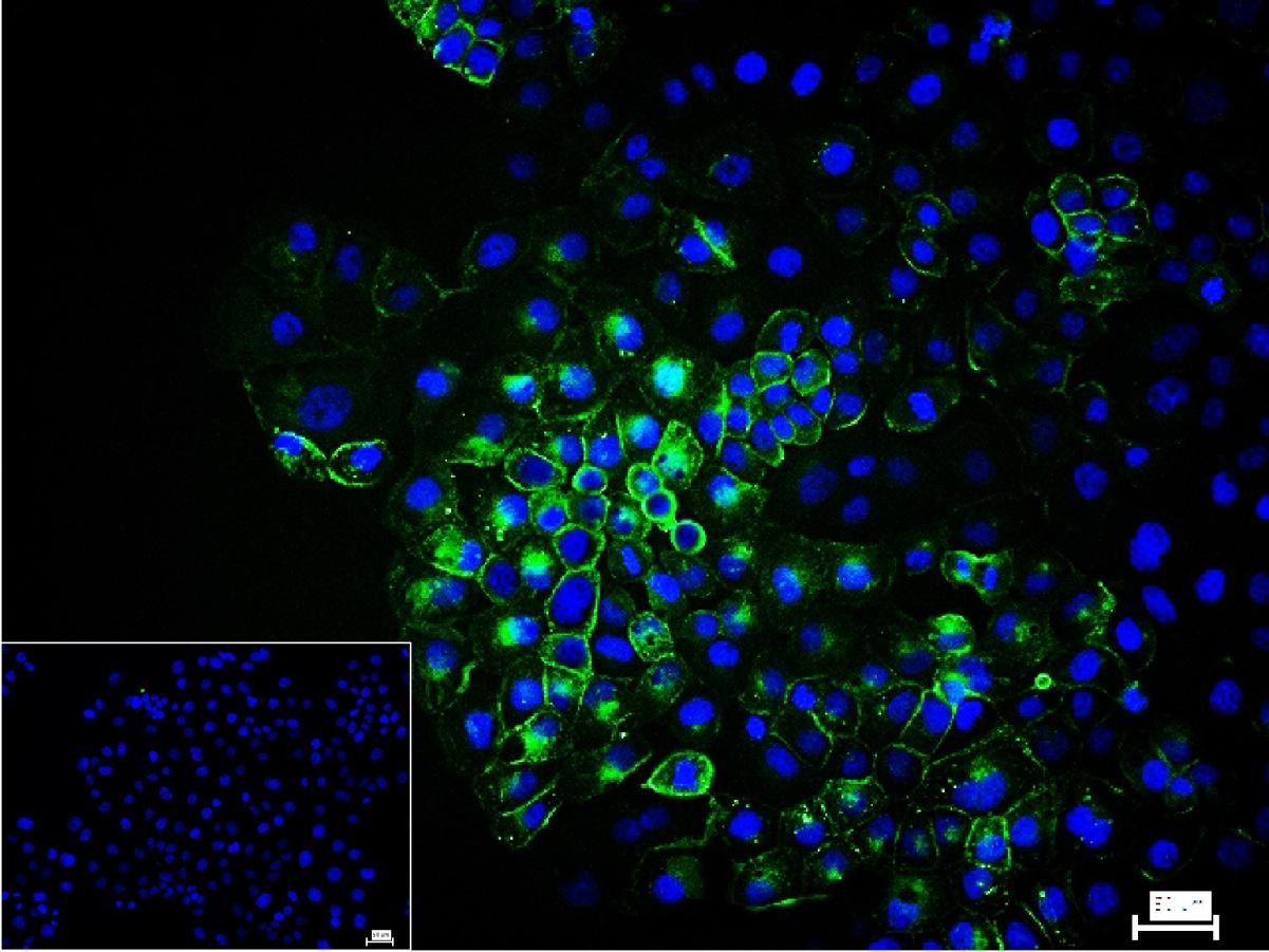 Anti-Mucin-16/MUC16 Antibody (8O689)