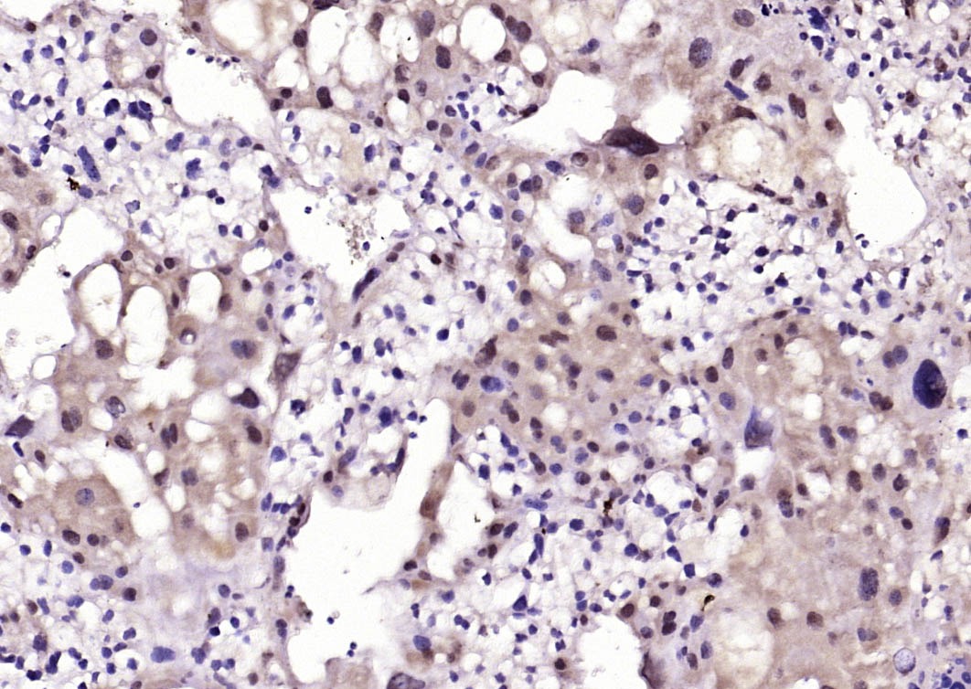 Anti-NFATC4 Polyclonal Antibody