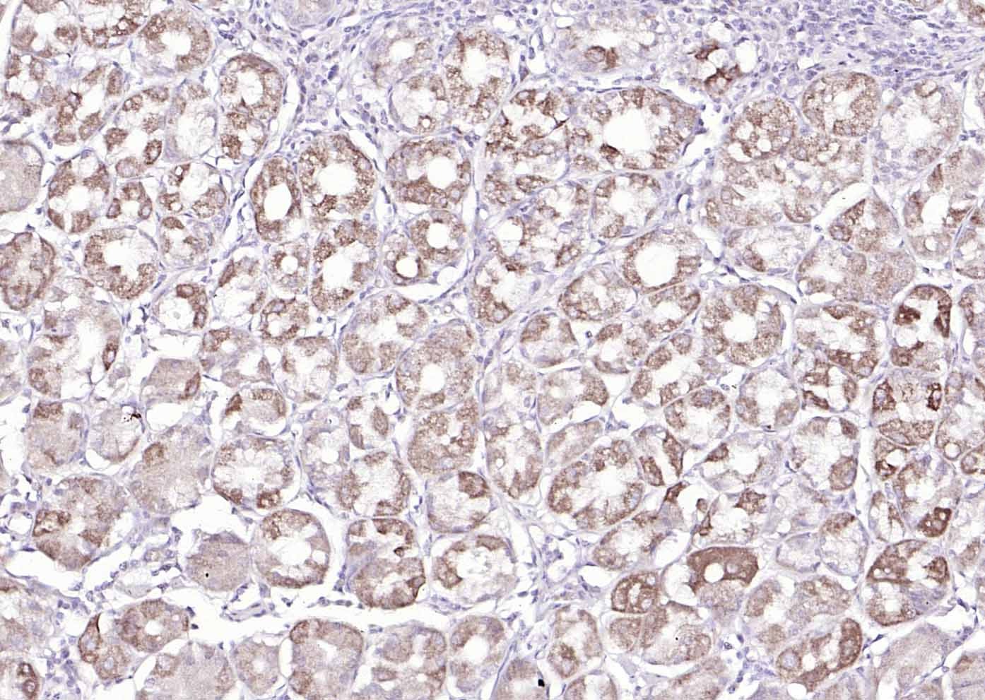 Anti-MUC5AC Polyclonal Antibody