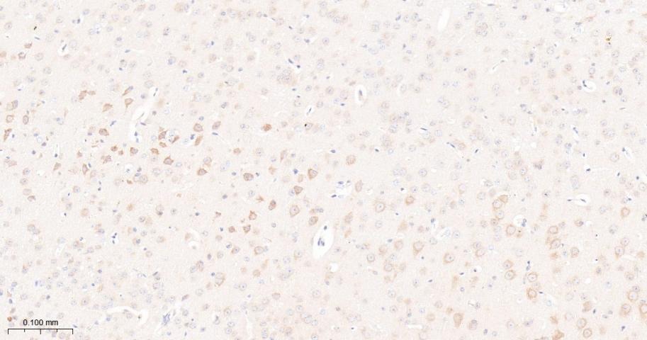 Anti-mTOR Antibody (2K378)