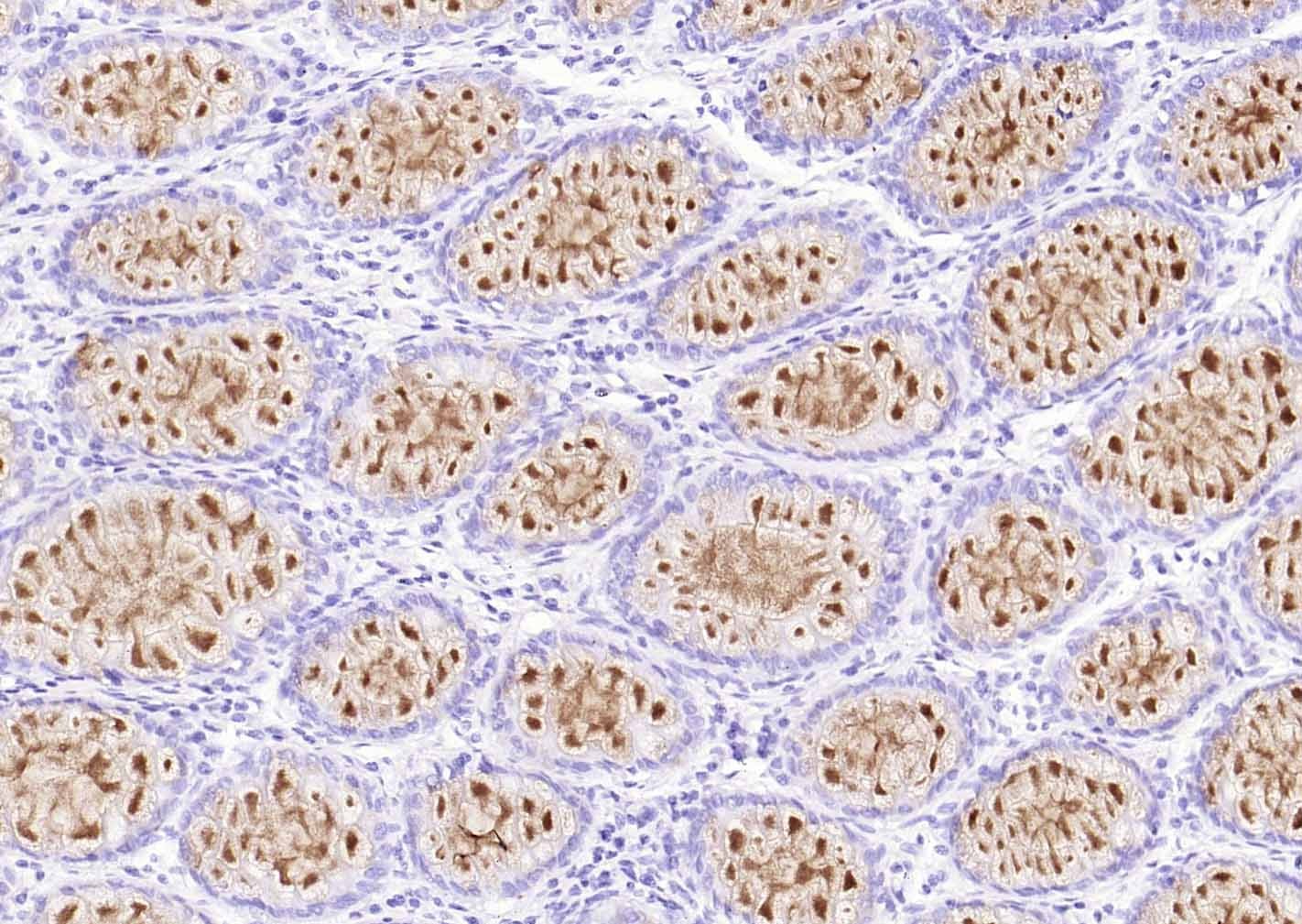 Anti-Mucin-2/MUC2 Antibody (1B747)