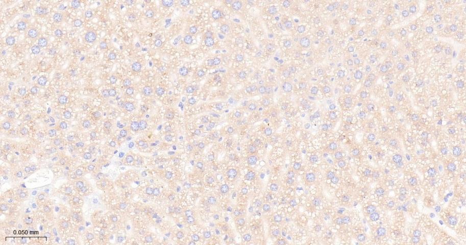 Anti-mTOR Antibody (2K378)