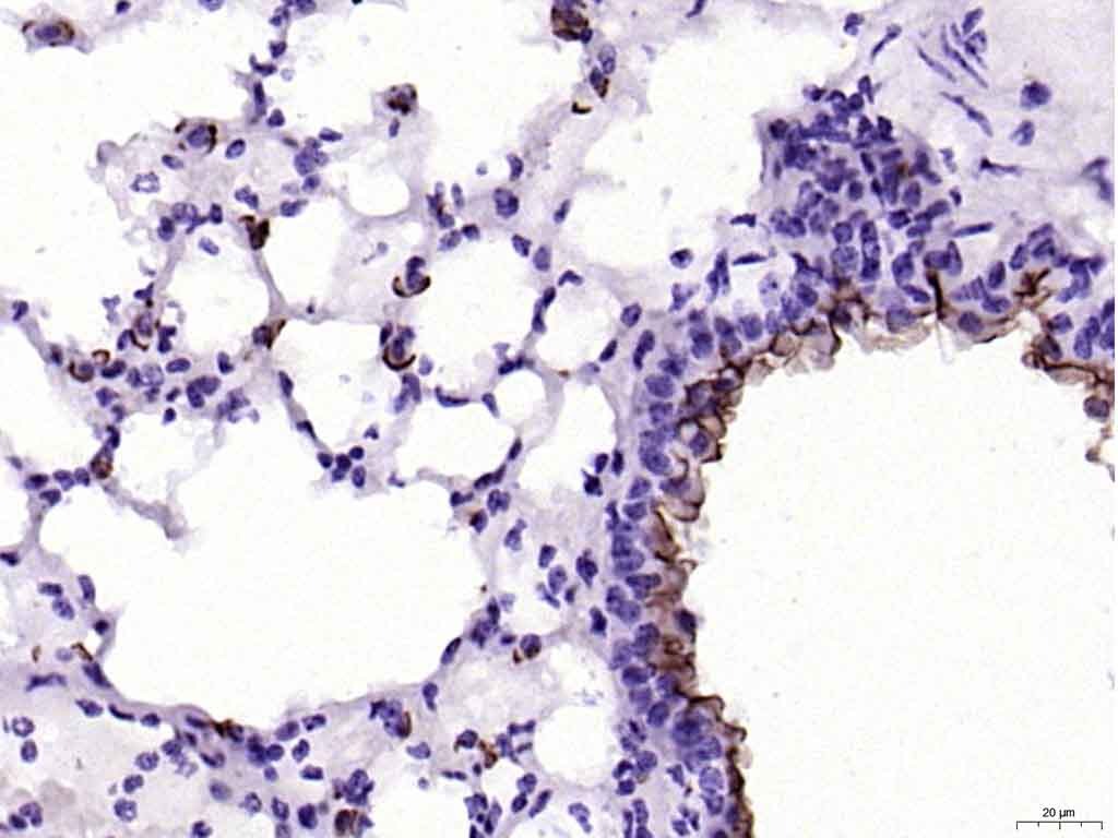 Anti-Mucin-1/MUC1 Polyclonal Antibody