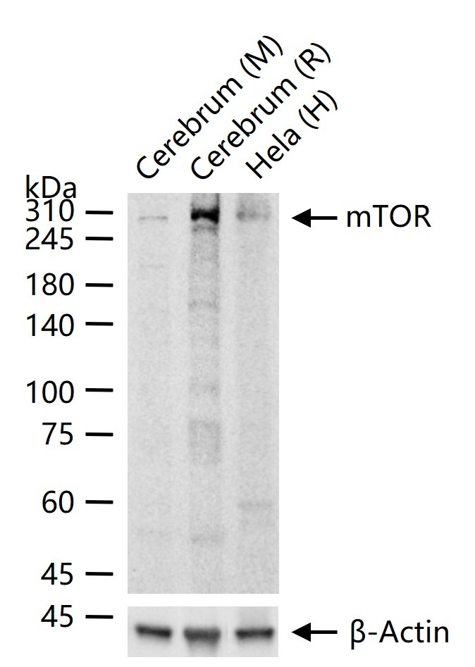 Anti-mTOR Antibody (2K378)