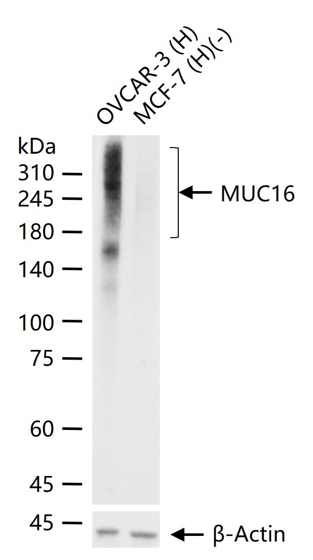 Anti-Mucin-16/MUC16 Antibody (8O689)