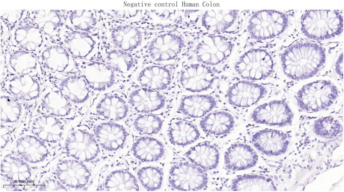 Anti-Mucin-16/MUC16 Antibody (8O689)