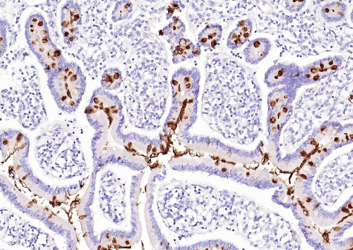 Anti-Mucin-2/MUC2 Antibody (1B747)