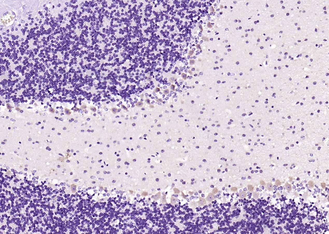 Anti-MXRA8 Polyclonal Antibody
