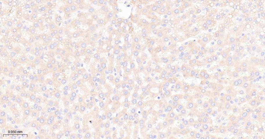Anti-mTOR Antibody (2K378)