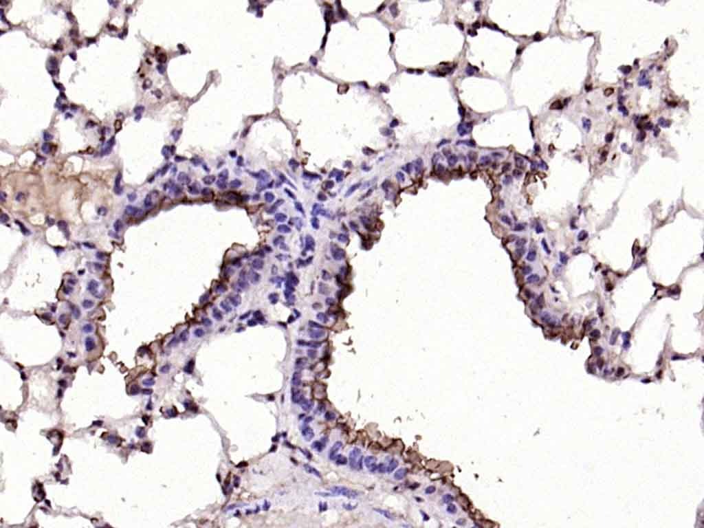 Anti-Mucin-1/MUC1 Polyclonal Antibody