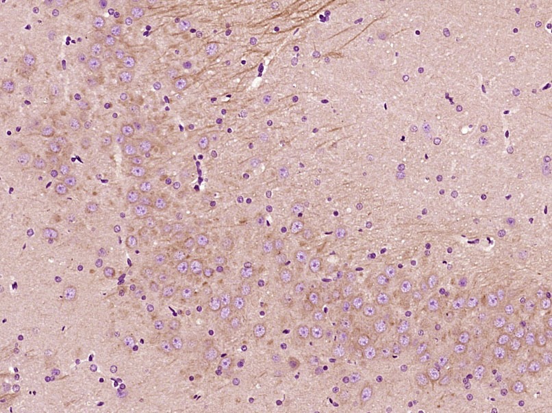 Anti-NFAT2 Polyclonal Antibody