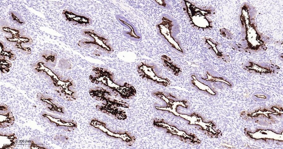 Anti-Mucin-16/MUC16 Antibody (8O689)