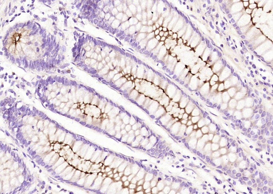 Anti-Mucin-1/MUC1 Polyclonal Antibody