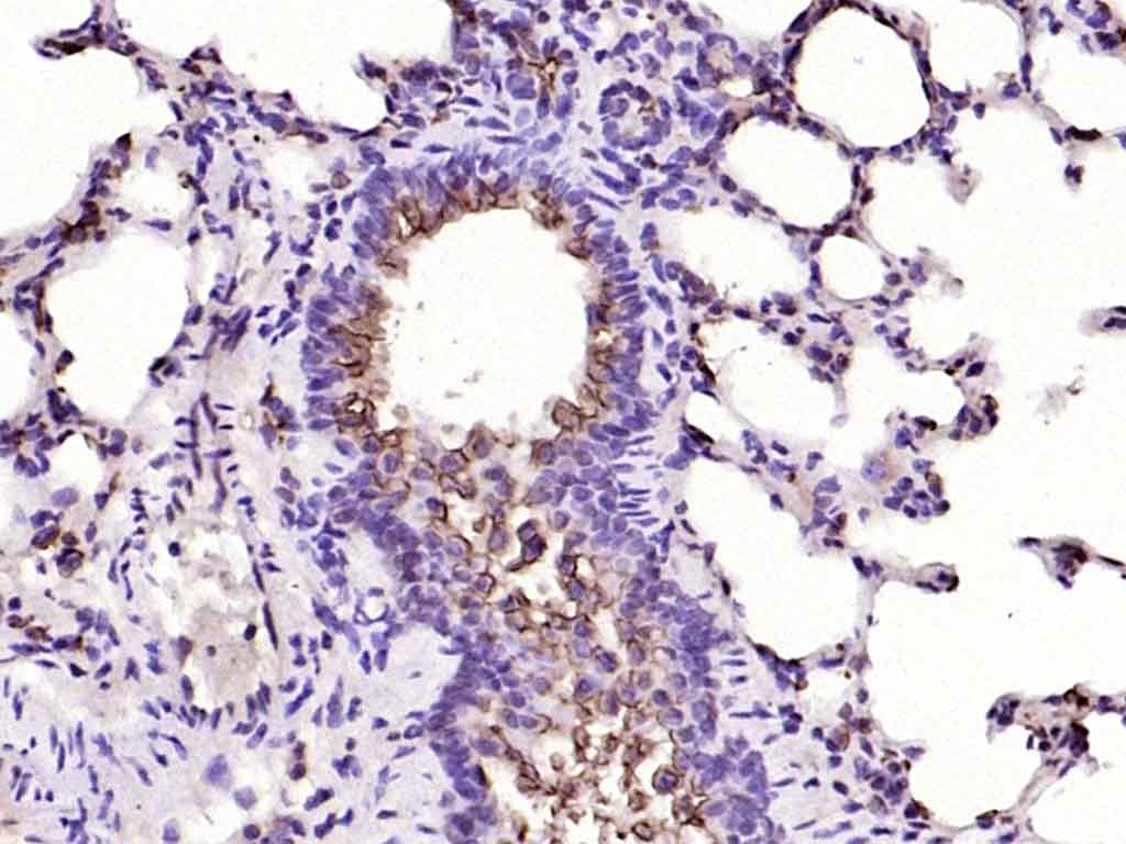Anti-Mucin-1/MUC1 Polyclonal Antibody