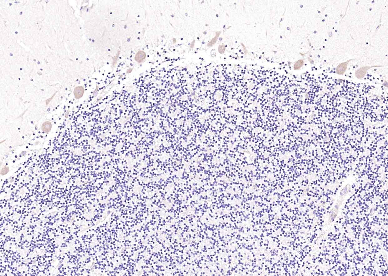 Anti-MXRA8 Polyclonal Antibody