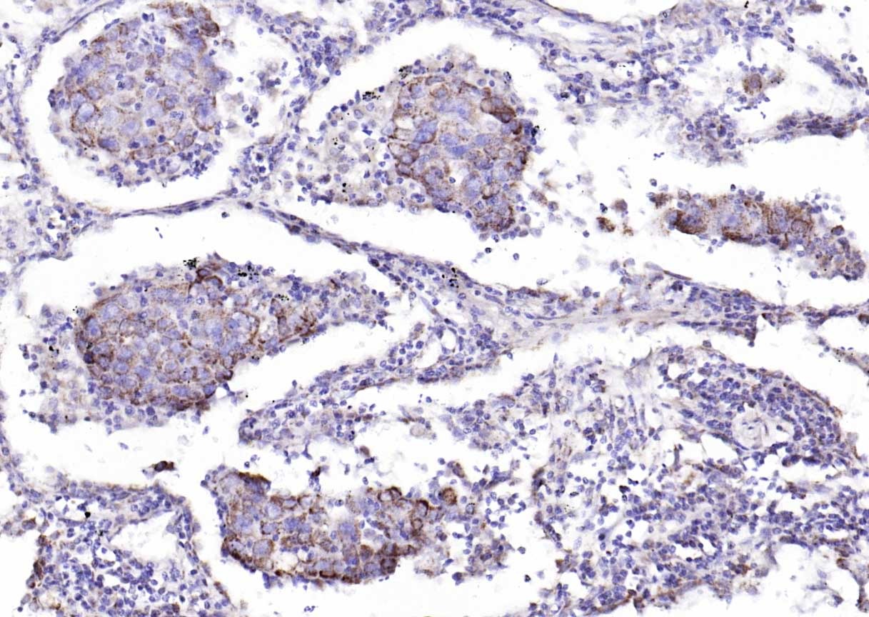 Anti-IKBKA Polyclonal Antibody