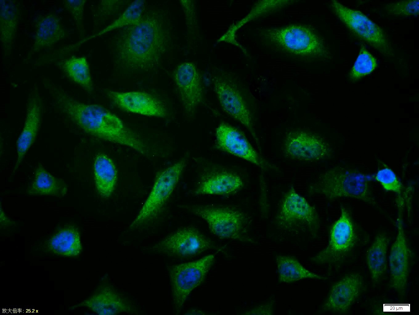 Anti-IkB alpha/NFKBIA Polyclonal Antibody