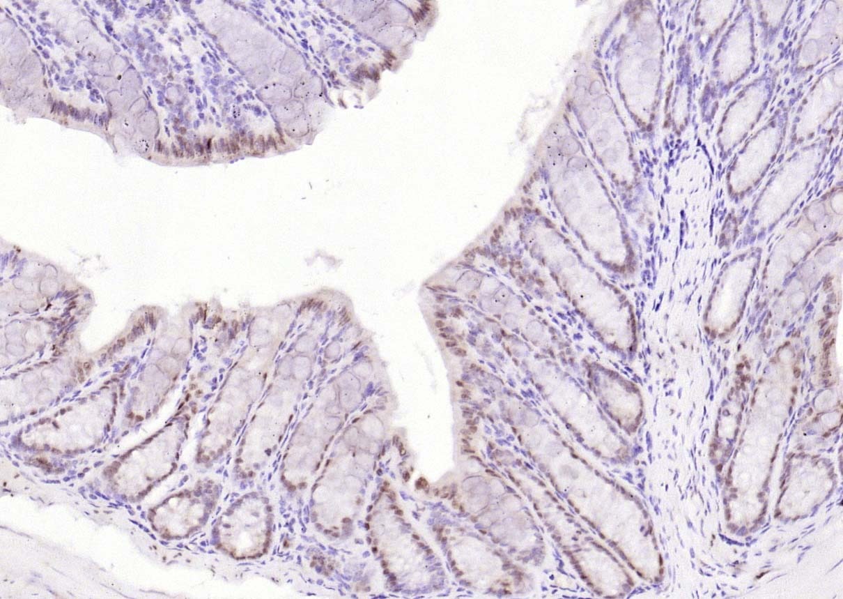 Anti-IKBKA Polyclonal Antibody