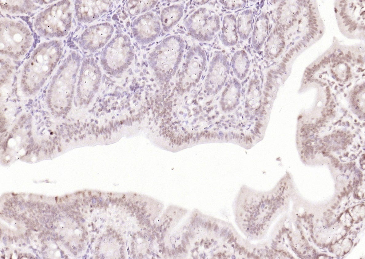 Anti-IKBKA Polyclonal Antibody