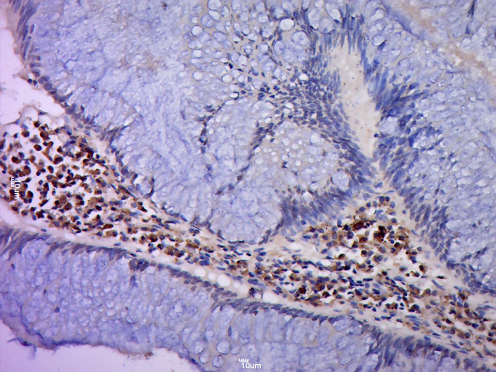 Anti-NRF1 Polyclonal Antibody