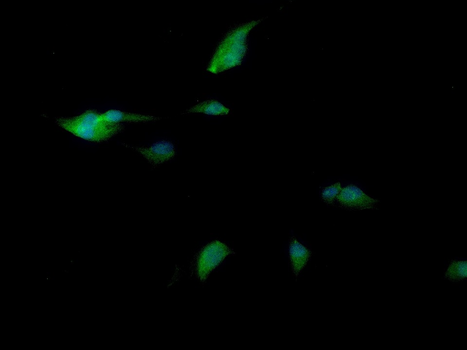 Anti-Olig-2/Oligo2 Polyclonal Antibody