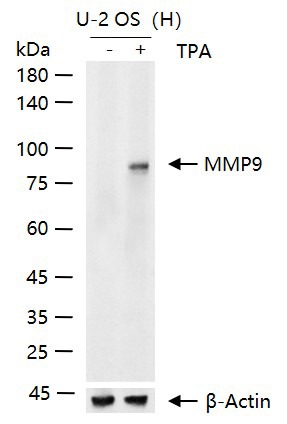 Anti-MMP-9 Polyclonal Antibody 3